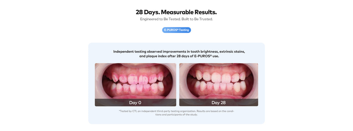 Side-by-side teeth photos labeled Day 0 and Day 28 in an E-PUROS oral-care results comparison.